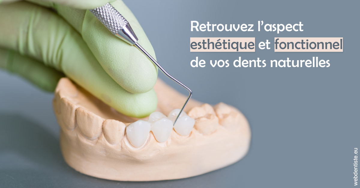 https://dr-francisci-mc.chirurgiens-dentistes.fr/Restaurations dentaires 1