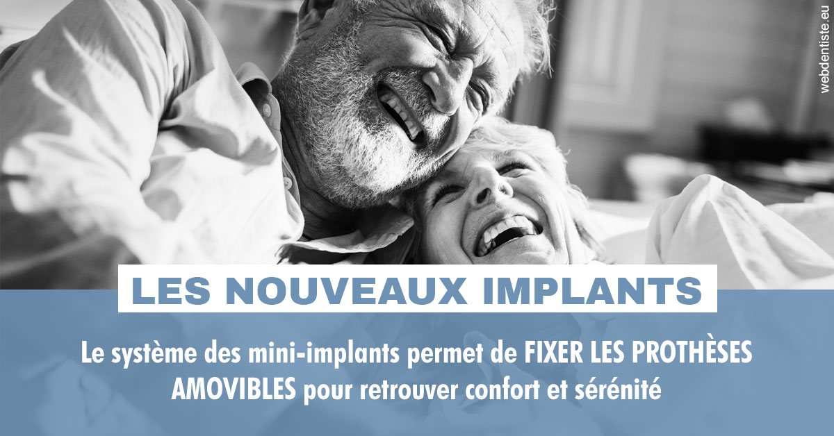 https://dr-francisci-mc.chirurgiens-dentistes.fr/Les nouveaux implants 2