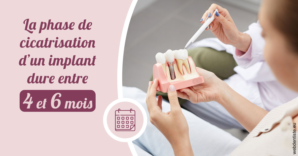 https://dr-francisci-mc.chirurgiens-dentistes.fr/Cicatrisation implant 2