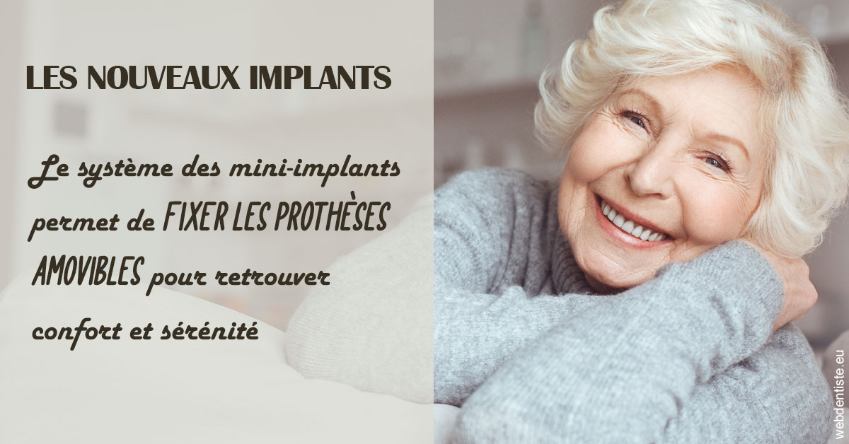 https://dr-francisci-mc.chirurgiens-dentistes.fr/Les nouveaux implants 1