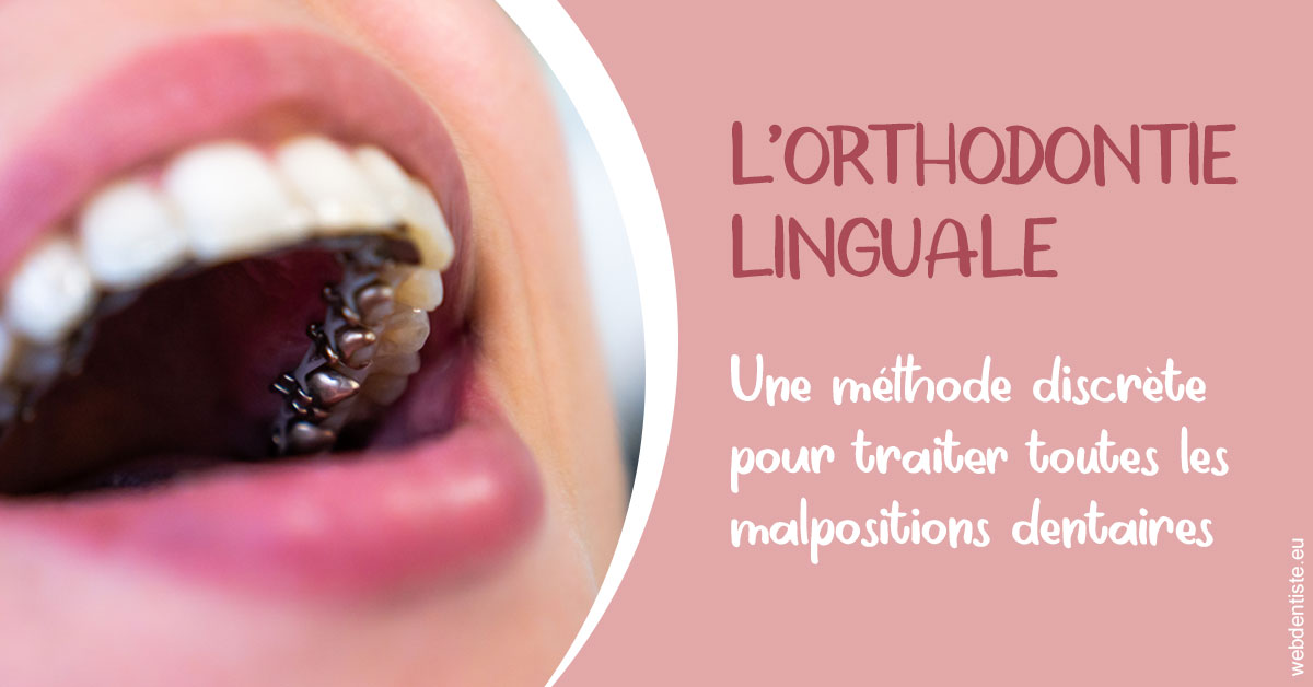 https://dr-francisci-mc.chirurgiens-dentistes.fr/L'orthodontie linguale 2
