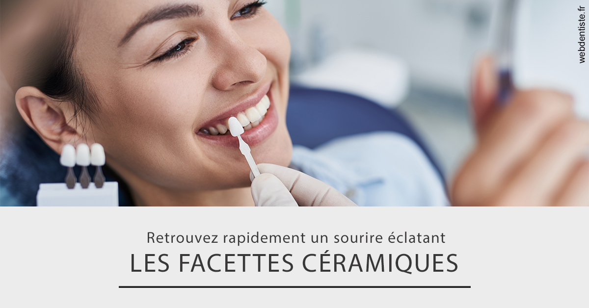 https://dr-francisci-mc.chirurgiens-dentistes.fr/Les facettes céramiques 2