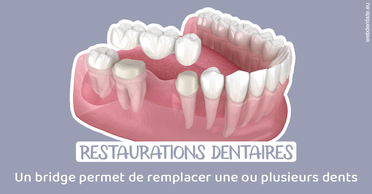 https://dr-francisci-mc.chirurgiens-dentistes.fr/Bridge remplacer dents 1