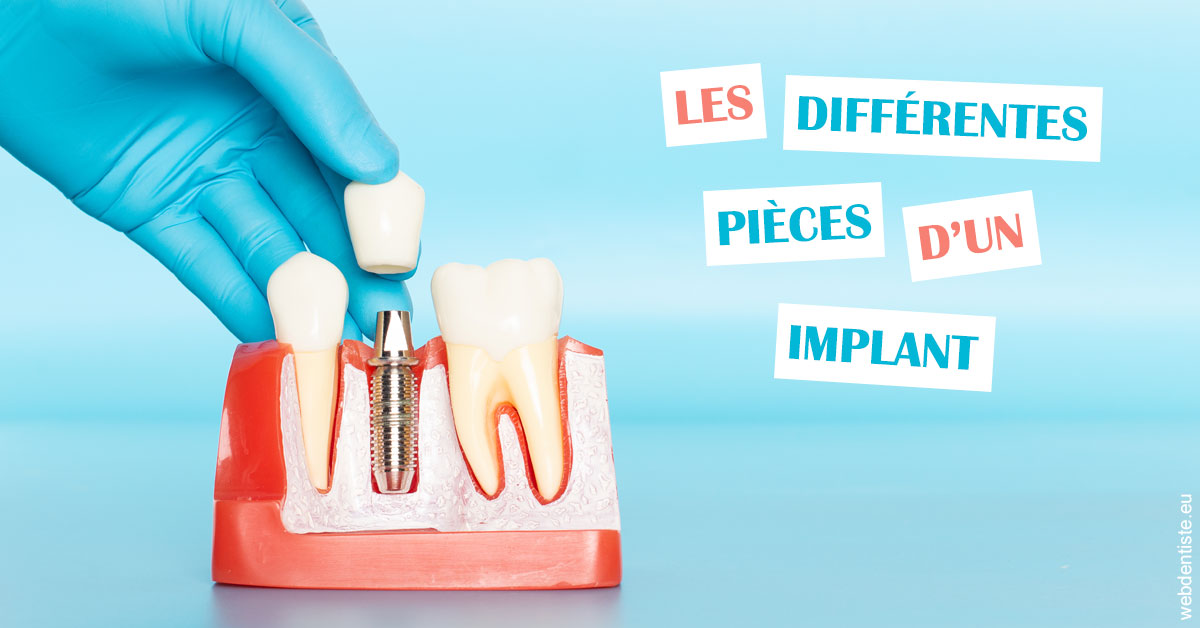 https://dr-francisci-mc.chirurgiens-dentistes.fr/Les différentes pièces d’un implant 2