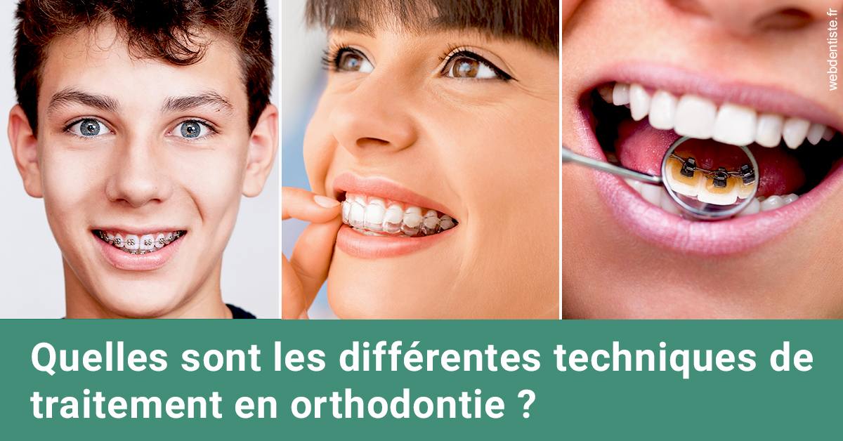 https://dr-francisci-mc.chirurgiens-dentistes.fr/Les différentes techniques de traitement 2