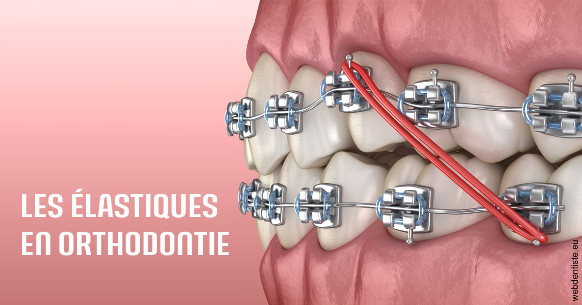 https://dr-francisci-mc.chirurgiens-dentistes.fr/Elastiques orthodontie 2