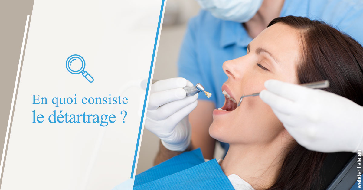 https://dr-francisci-mc.chirurgiens-dentistes.fr/En quoi consiste le détartrage