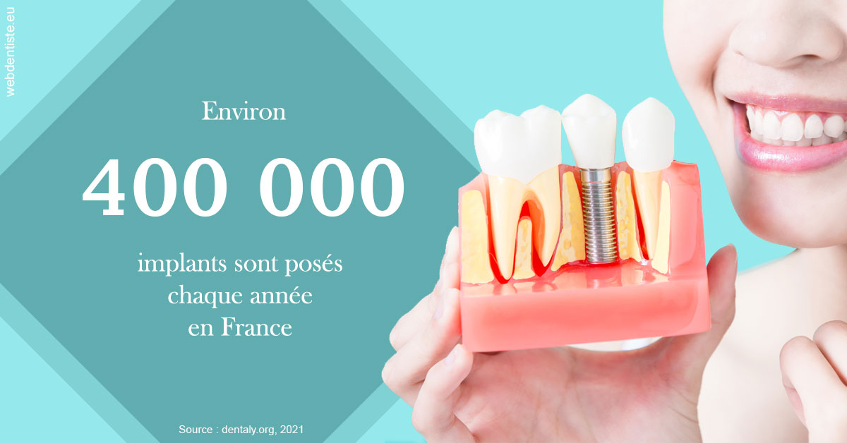 https://dr-francisci-mc.chirurgiens-dentistes.fr/Pose d'implants en France 2